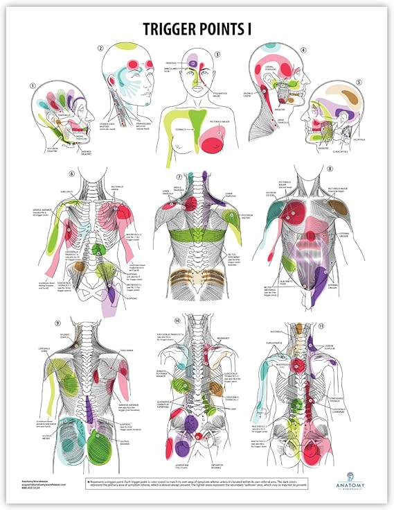 Anatomy Lab Trigger Points I Laminated Poster | 17.3 x 22.5 Inch Detailed Anatomy & Physiology Chart of Muscle Trigger Points for Study, Classroom