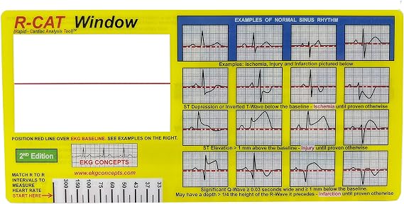 R-CAT EKG Interpretation Tool Window